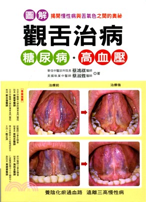 觀舌治病－糖尿病．高血壓：圖解揭開慢性病與舌氣色之間的奧祕