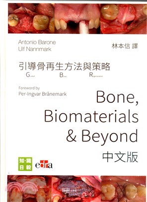 引導骨再生方法與策略Bone, Biomaterials & Beyond(中文版)