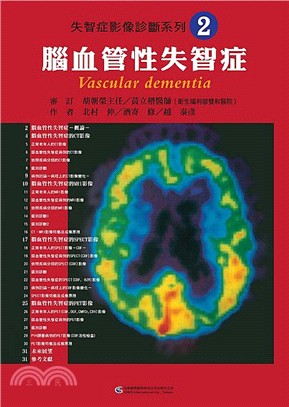失智症影像診斷系列02：腦血管性失智症