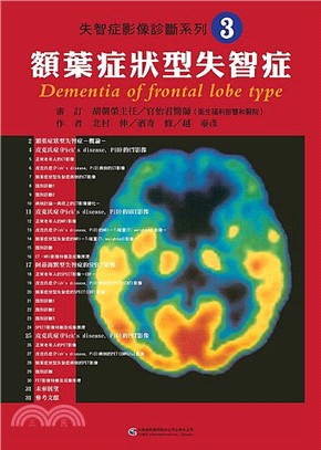 失智症影像診斷系列03：額葉症狀型失智症