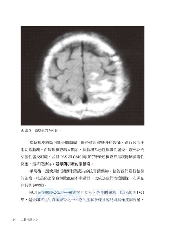 大腦神經兮兮：神經內科專家的行醫筆記