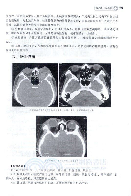 實用臨床CT診斷圖解(第2版)（簡體書）