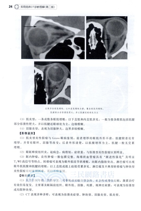 實用臨床CT診斷圖解(第2版)（簡體書）