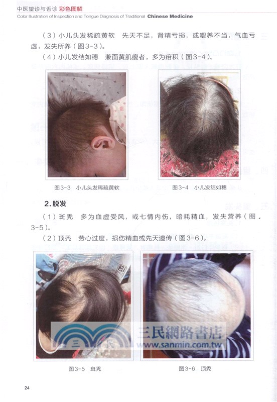 中醫望診與舌診彩色圖解（簡體書）