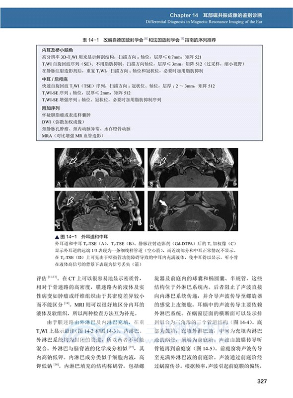 腦部及頭頸部影像學精要：附成像原理與基礎（簡體書）