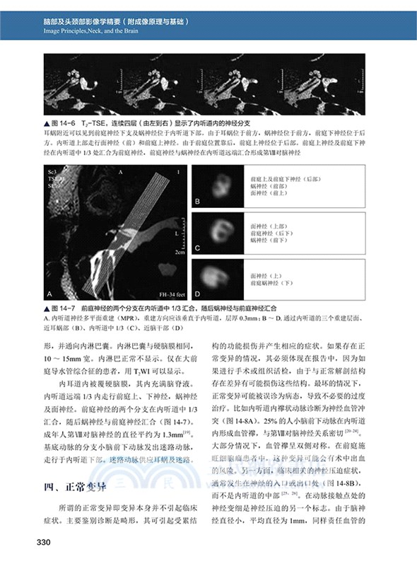 腦部及頭頸部影像學精要：附成像原理與基礎（簡體書）