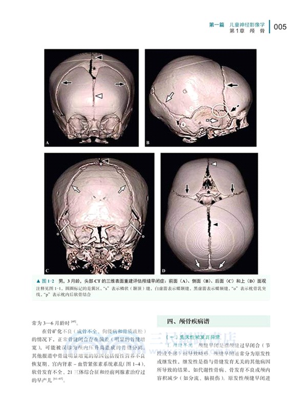 兒科影像診斷學（簡體書）