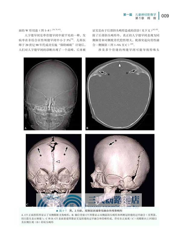 兒科影像診斷學（簡體書）