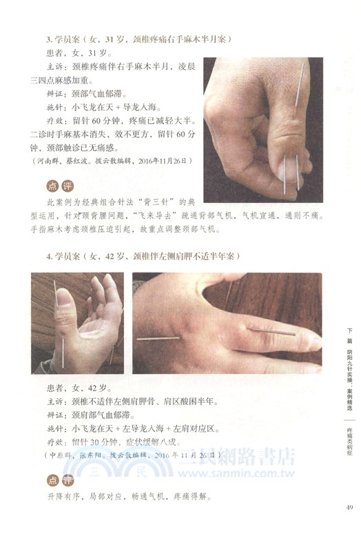 陰陽九針2：陰陽九針技巧進階與案例精選（簡體書）