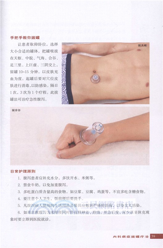 零基礎學拔罐（簡體書）