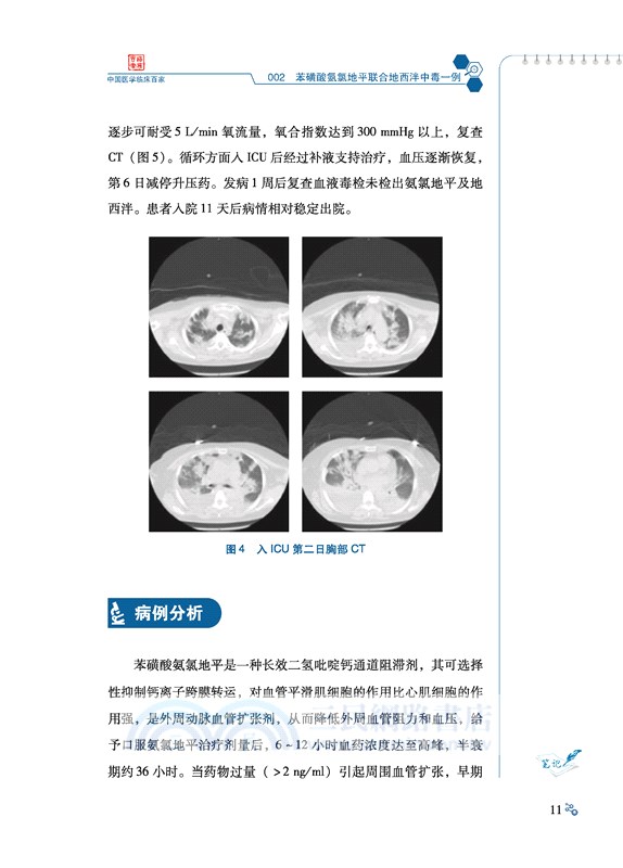 首都醫科大學附屬北京友誼醫院重症醫學科常見疾病病例精解（簡體書）