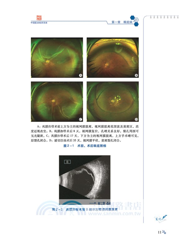 陝西省眼科醫院病例精解（簡體書）
