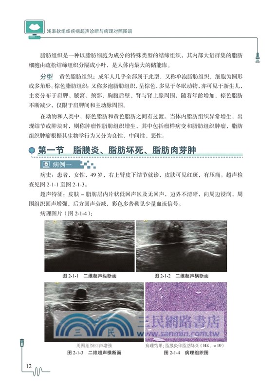 淺表軟組織疾病超聲診斷與病理對照圖譜（簡體書）