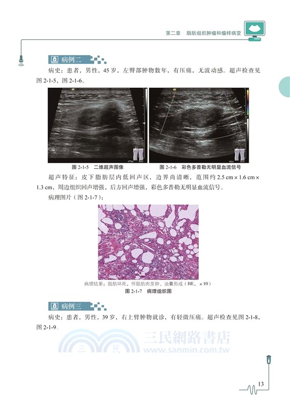 淺表軟組織疾病超聲診斷與病理對照圖譜（簡體書）