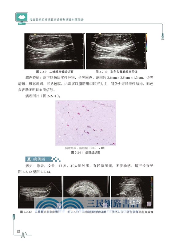 淺表軟組織疾病超聲診斷與病理對照圖譜（簡體書）