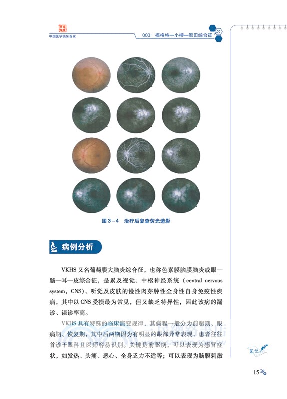 山西醫科大學第二醫院神經內科病例精解（簡體書）