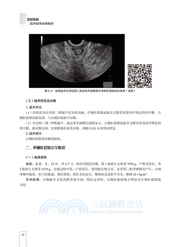 盆底疾病超聲疑難病例解析（簡體書）