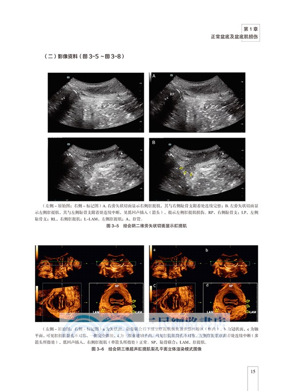 盆底疾病超聲疑難病例解析（簡體書）