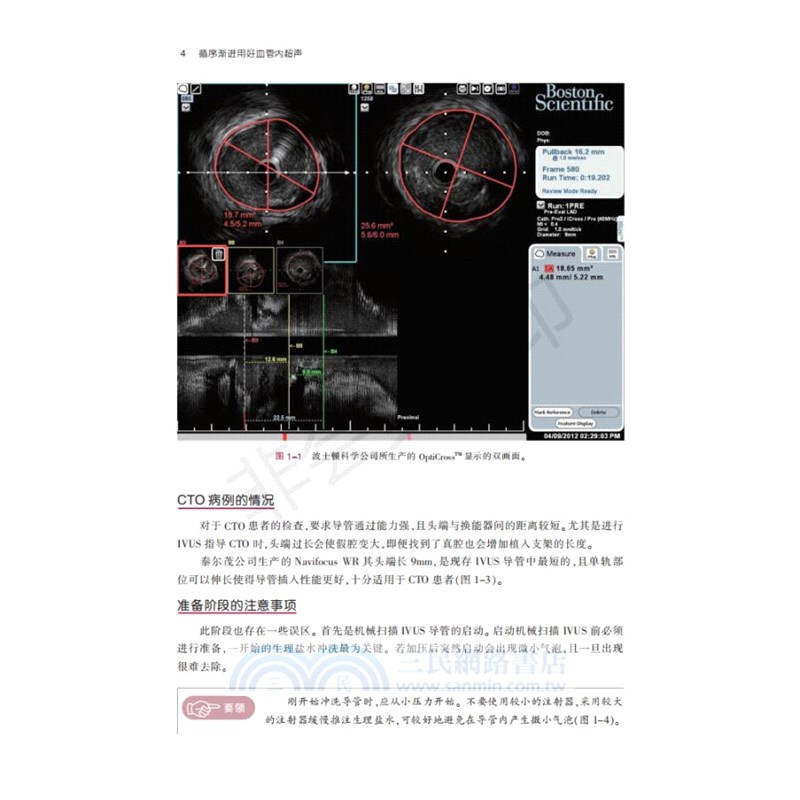 循序漸進用好血管內超聲（簡體書）