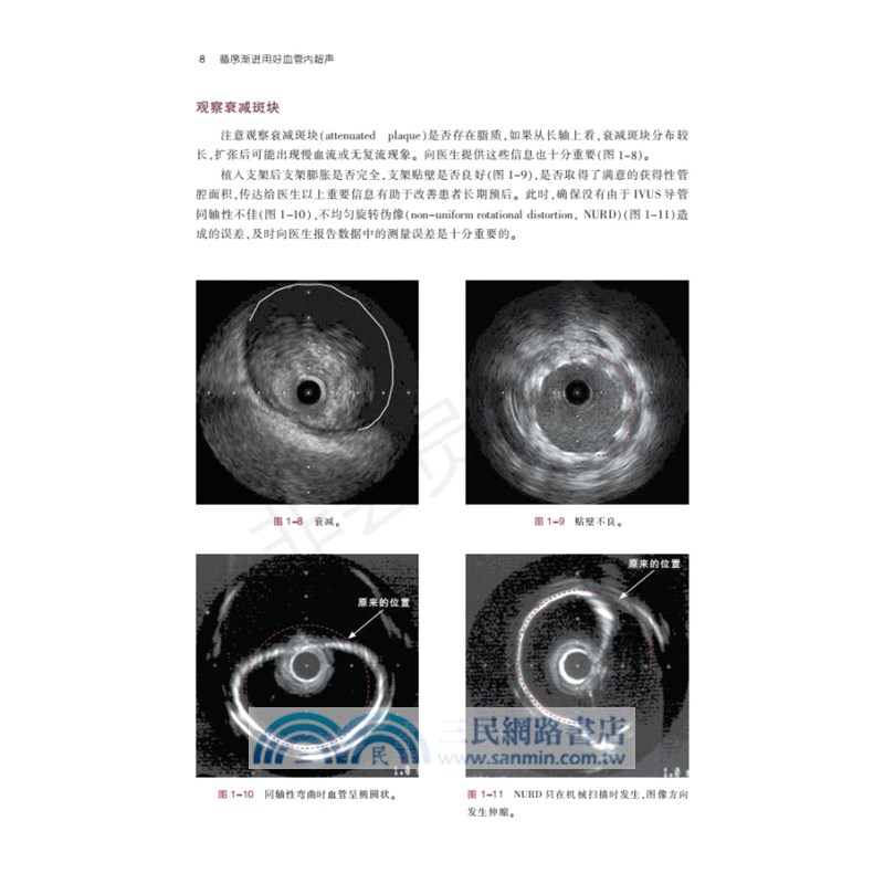 循序漸進用好血管內超聲（簡體書）