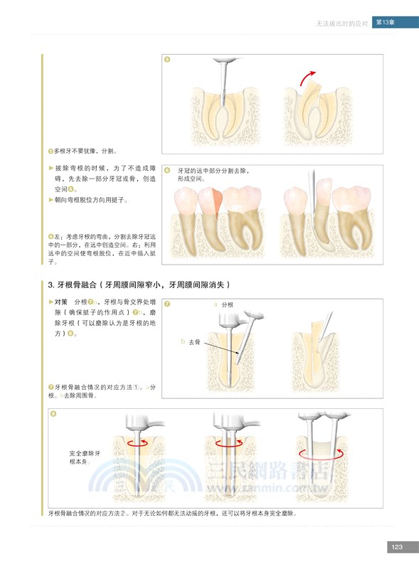 必成高手：拔牙技巧（簡體書）