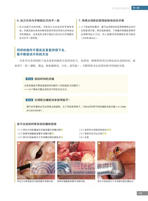 必成高手：拔牙技巧（簡體書）