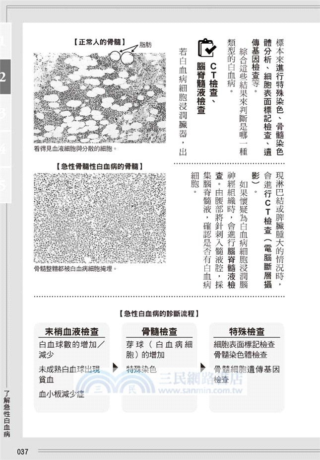 白血病：認識血液疾病診斷與治療法