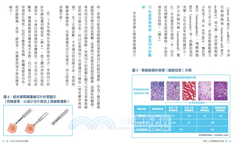 逆癌：泌尿腫瘤最新指南