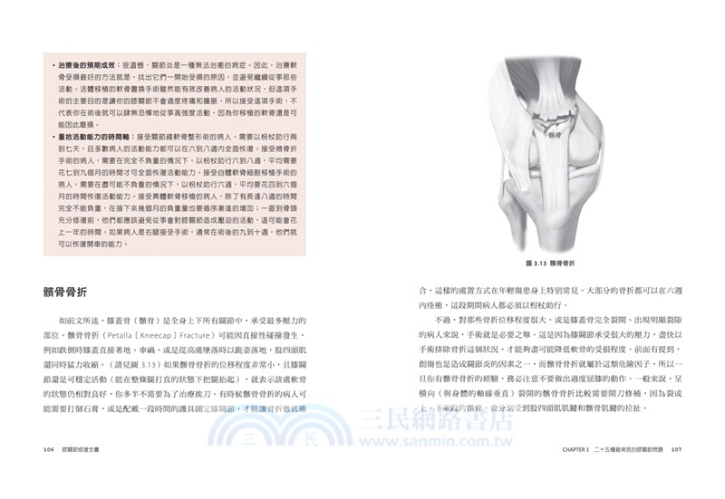 膝關節修復全書：慢性膝蓋痛‧退化性關節炎‧十字韌帶撕裂，25種常見膝蓋問題的修復照護指南