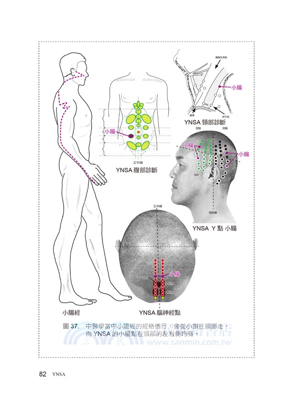 YNSA 山元式頭針療法 - 本