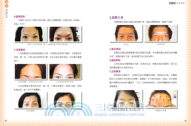 搶救微整型：你應該知道的28種異常個案