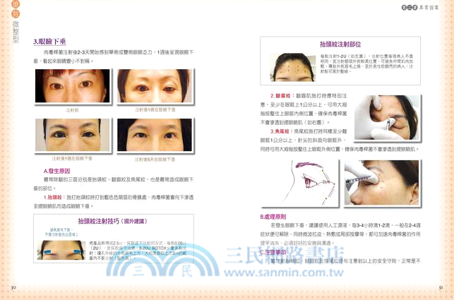 搶救微整型：你應該知道的28種異常個案