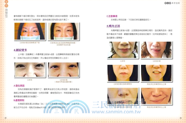 搶救微整型：你應該知道的28種異常個案