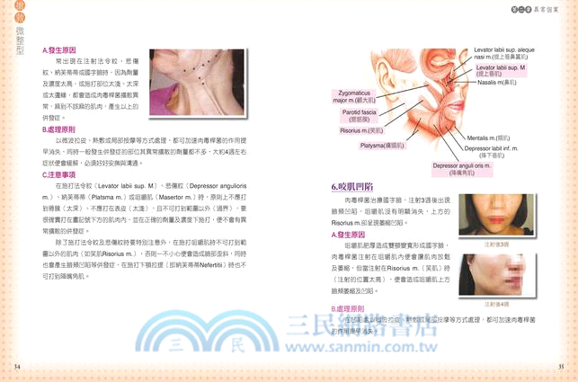 搶救微整型：你應該知道的28種異常個案