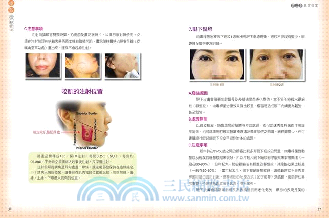 搶救微整型：你應該知道的28種異常個案