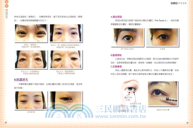 搶救微整型：你應該知道的28種異常個案