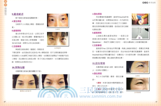 搶救微整型：你應該知道的28種異常個案