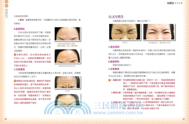 搶救微整型：你應該知道的28種異常個案