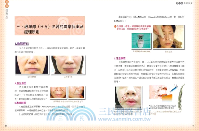 搶救微整型：你應該知道的28種異常個案