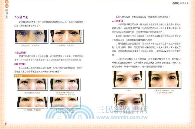 搶救微整型：你應該知道的28種異常個案