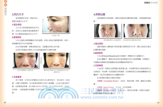 搶救微整型：你應該知道的28種異常個案