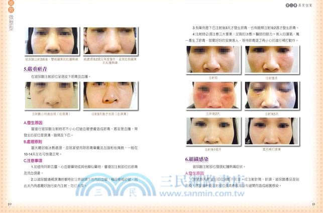 搶救微整型：你應該知道的28種異常個案