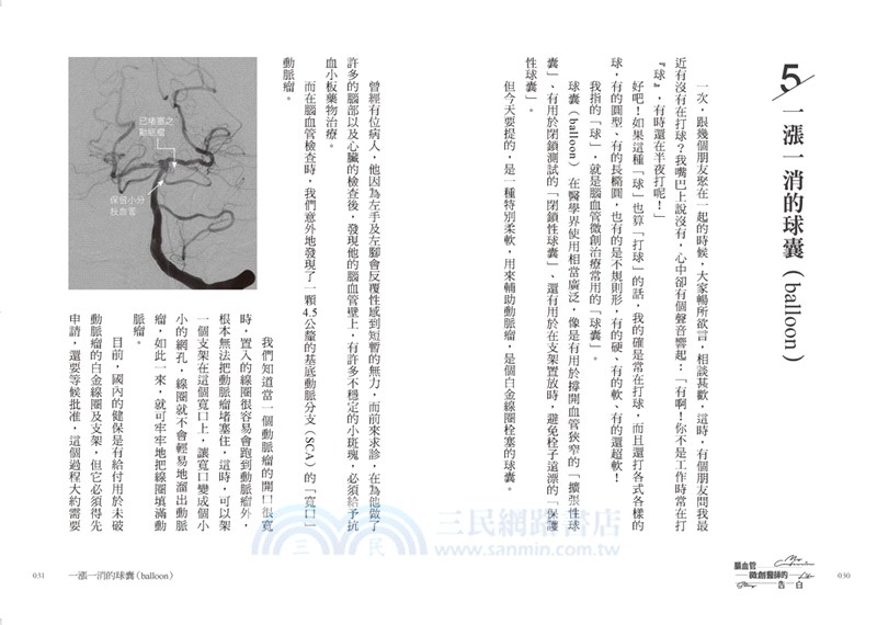 腦血管微創醫師的告白：撐開血栓，探見手術間錯綜複雜的人生