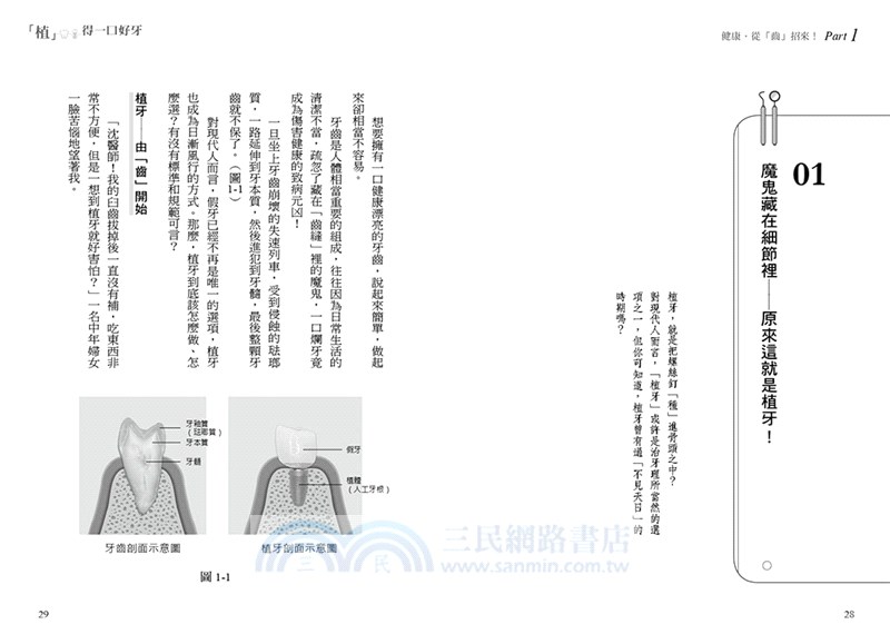 「植」得一口好牙：安心植牙大小事