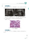 淺表軟組織疾病超聲診斷與病理對照圖譜（簡體書）