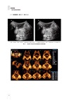 盆底疾病超聲疑難病例解析（簡體書）